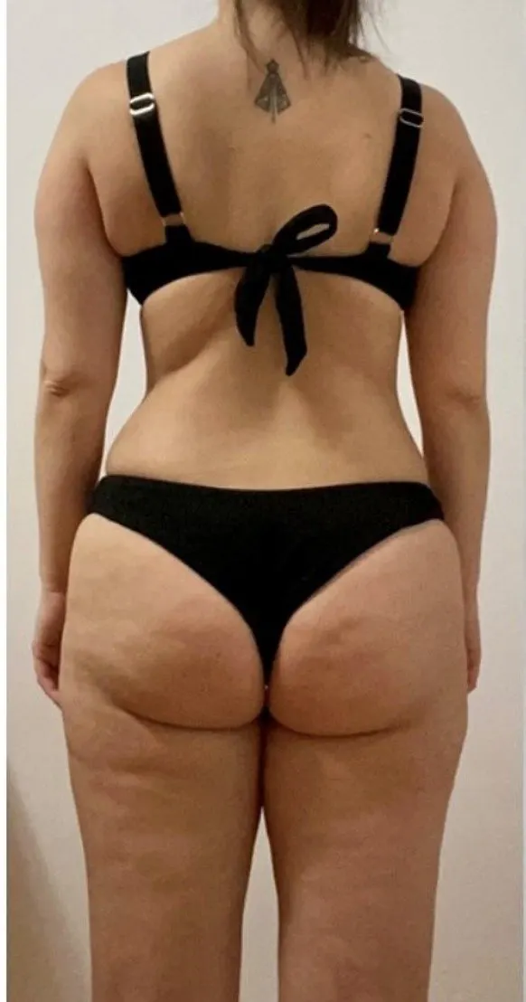 Client before the program