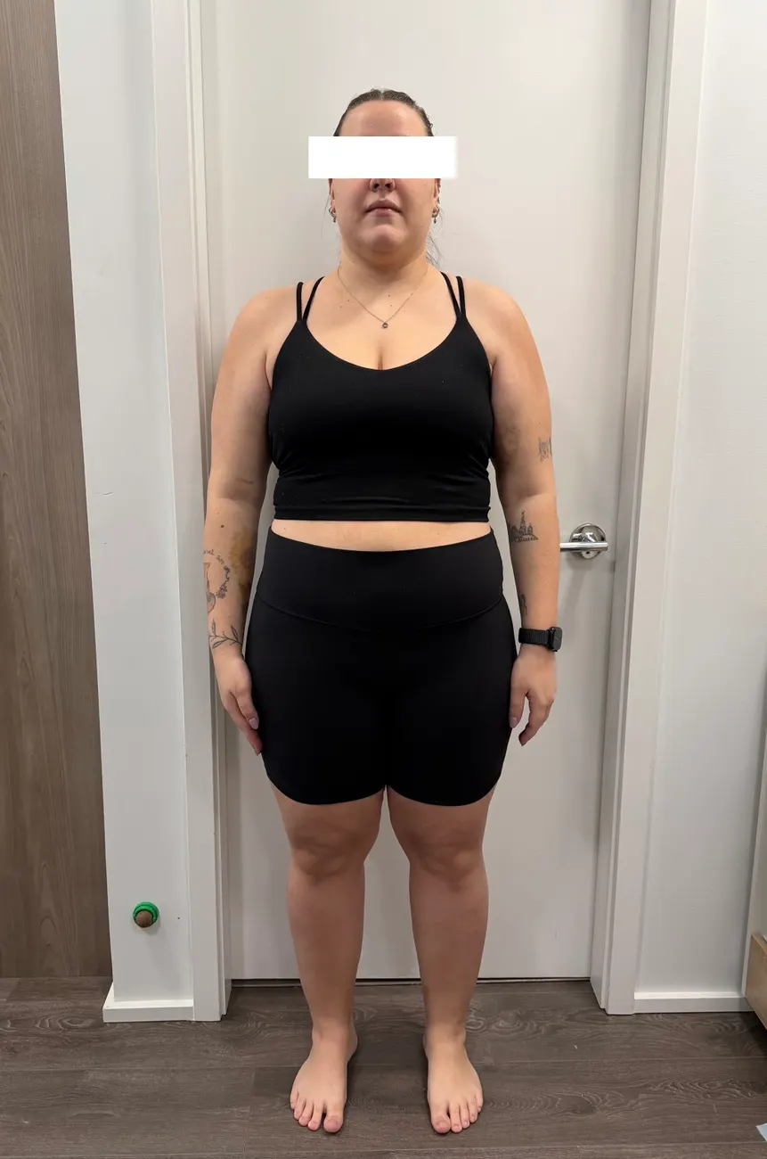 Client after the program, front view