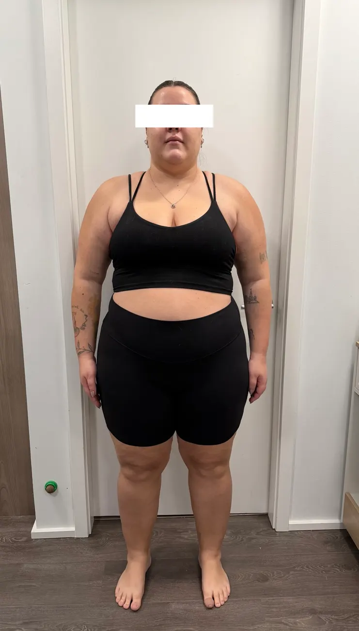 Client before the program, front view