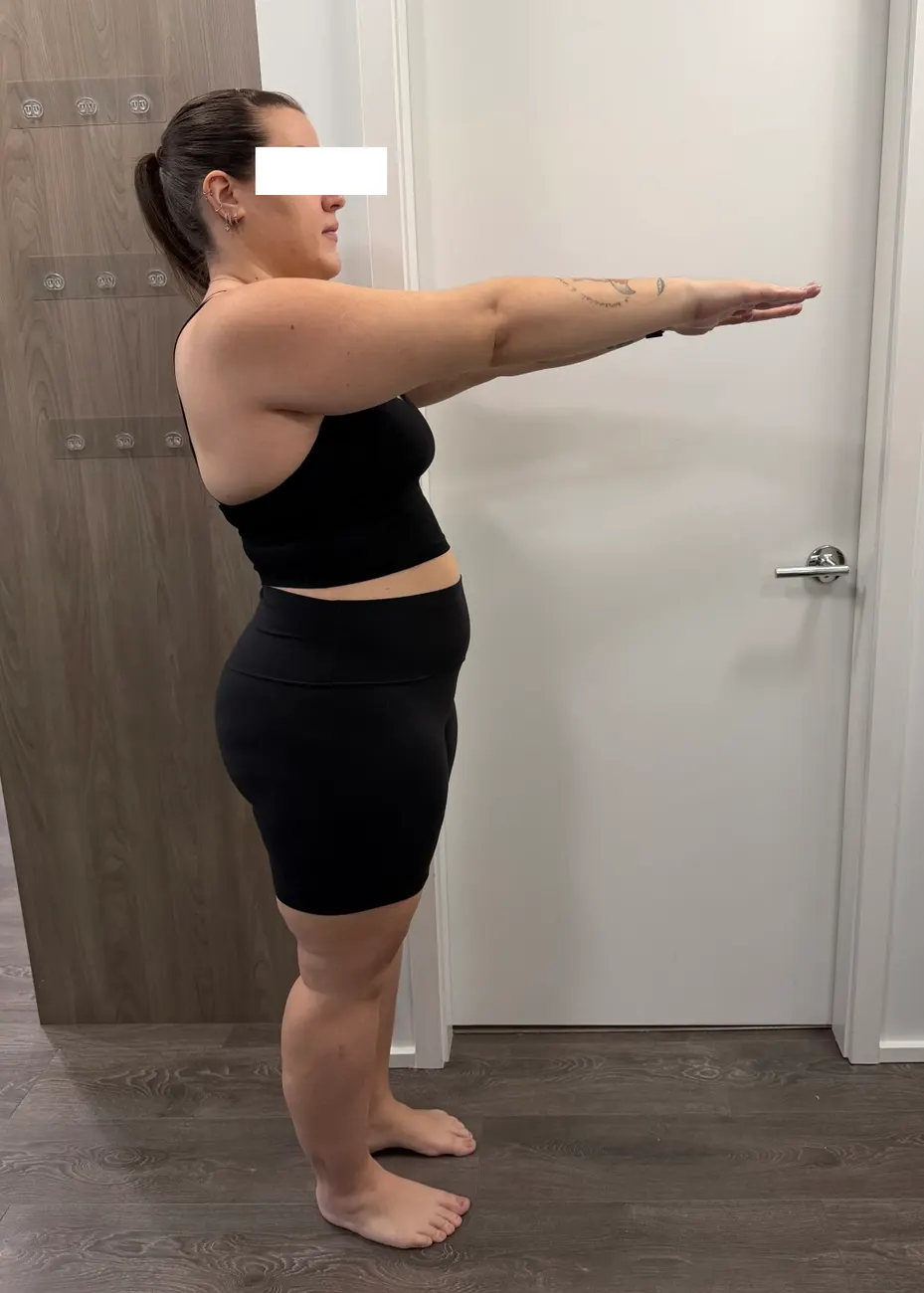 Client after the program, side view
