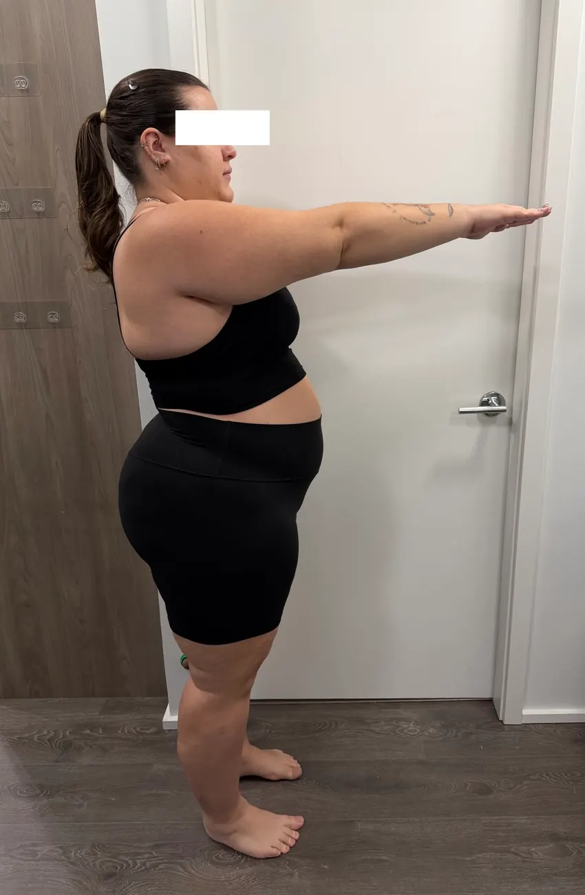 Client before the program, side view