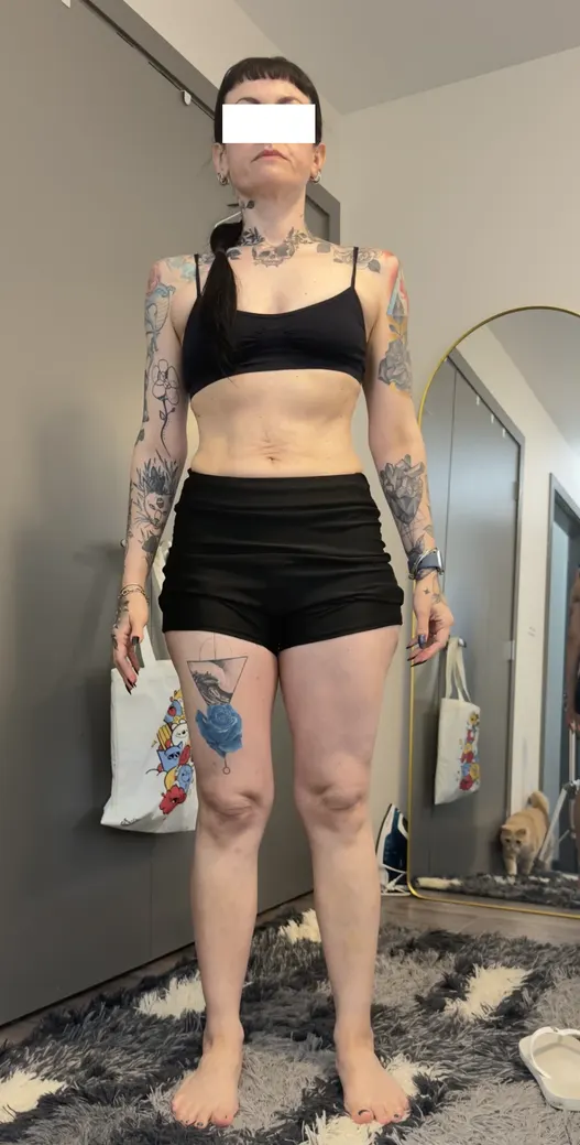 Client after the program, front view