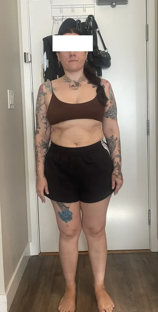 Client before the program, front view