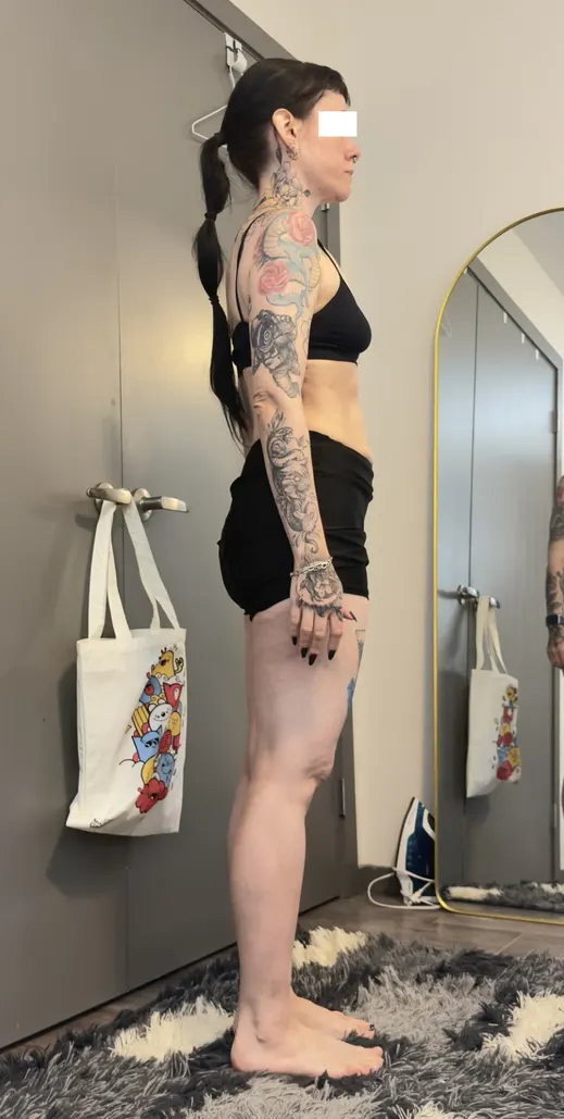 Client after the program, side view