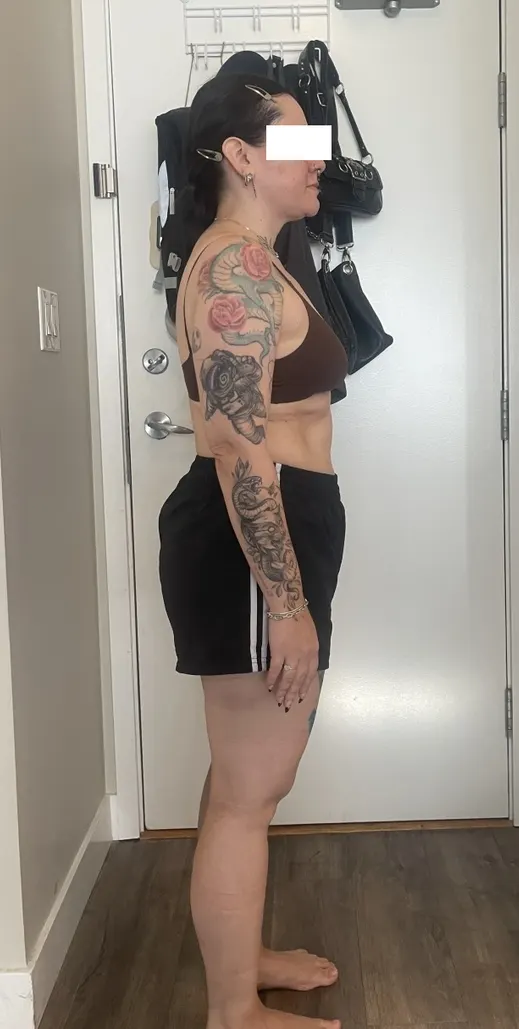 Client before the program, side view