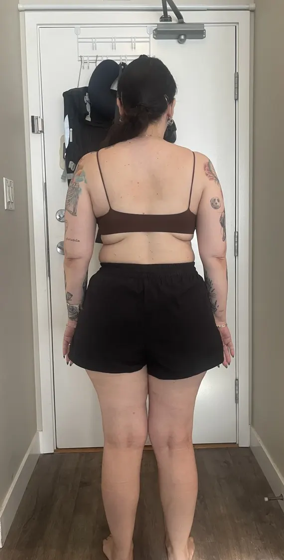 Client before the program, back view